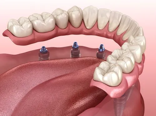 Sleep and Airway Solutions at Synera Dental Wellness