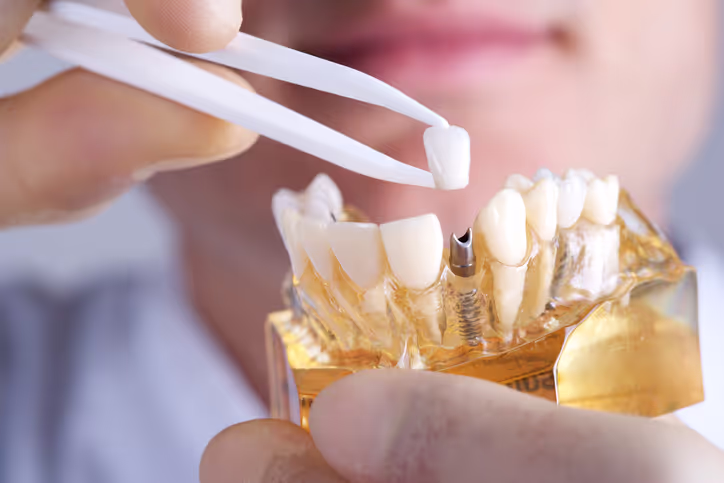 TMJ and TMD Treatment at Synera Dental Wellness